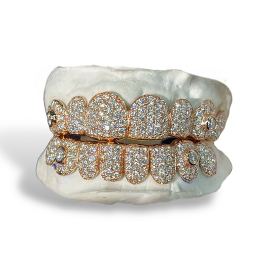 Jumbo and Bezel setting Grillz
